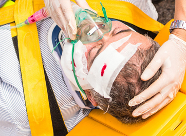 Head and face injuries