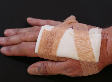 lacerations